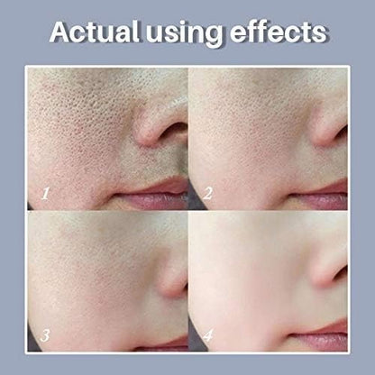 LANBENA - Pore Solution Serum